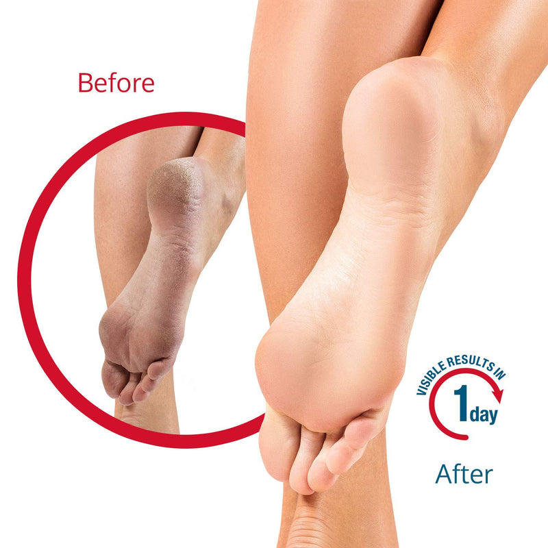 FLEXITOL Heel Balm Medically Proven Treatment for Dry and Cracked Feet - 56g |Gives Intense Moisturisation - NewNest Australia