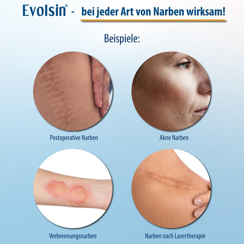 Evolsin® Transparent scar plaster - for all types of scars - silicone scar plaster visibly reduces scars - for easy treatment (200 cm) - NewNest Australia