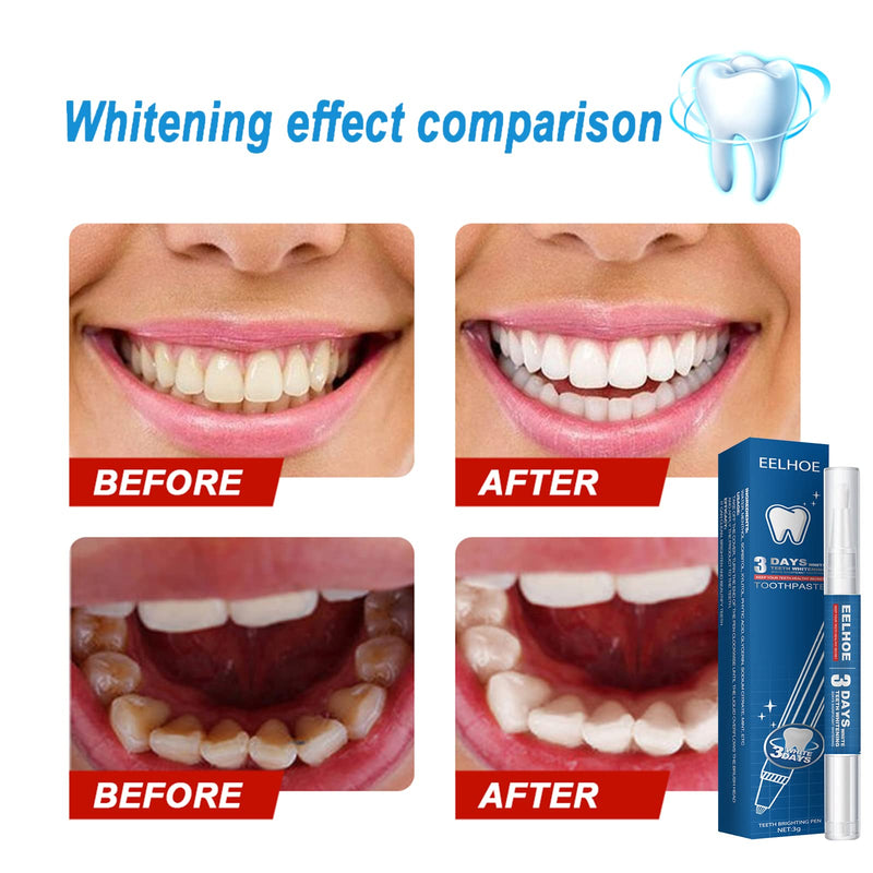 Teeth Whitening Pen - 2Pcs Tooth Gel Pen Teeth Whitening Gel Teeth Stain Remover to Whiten Teeth - Effective & Painless Whitening, No Sensitivity, Easy to Use, Natural Mint Flavor, - NewNest Australia