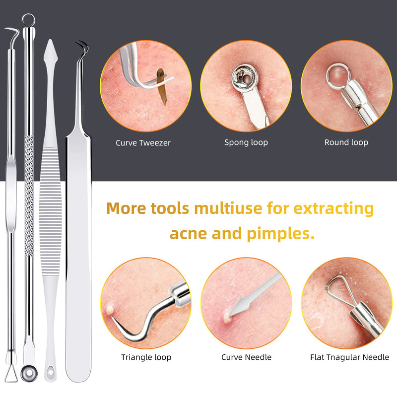 AIBEE 10 Pcs Blackhead Remover Pimple Popper Tool Kit,Comedone Extractor Tools for Acne, Blackhead,Whitehead,Pimples,Spot,Zit Removal Tool on Nose Face Skin Stainless Steel - NewNest Australia
