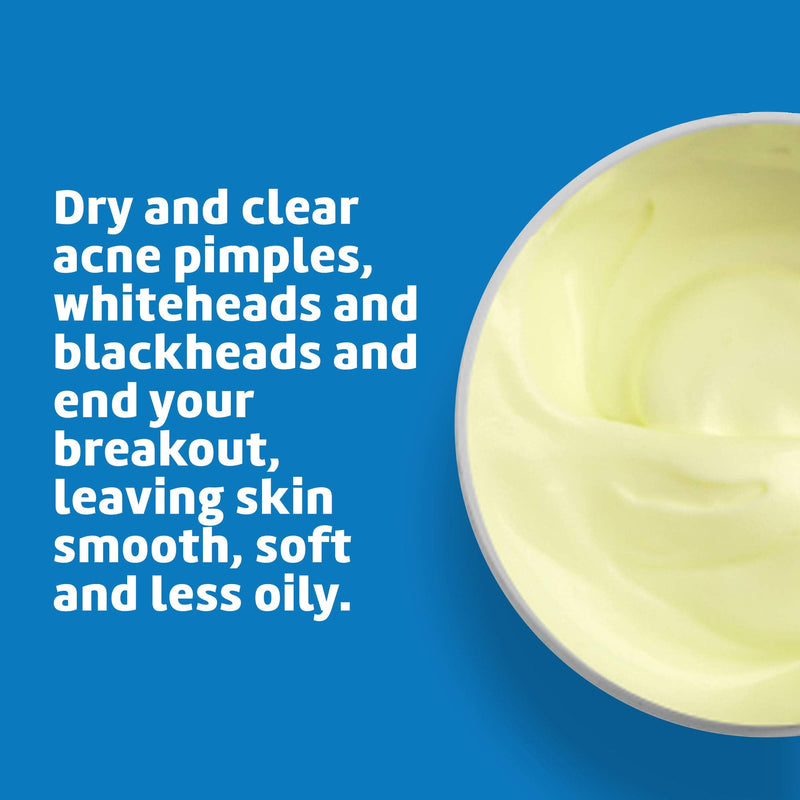 Dela cruz acne treatment, Sulfur Ointment - Pomada de Azufre - NewNest Australia