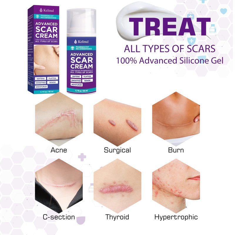 Kelinul Scar Cream-Advanced Silicone Gel for C-Section, Stretch Marks, Acne, Surgery, Effective both Old and New Scars- Advanced Post Supplies-Try Surgical Sheets-1.7 oz - NewNest Australia
