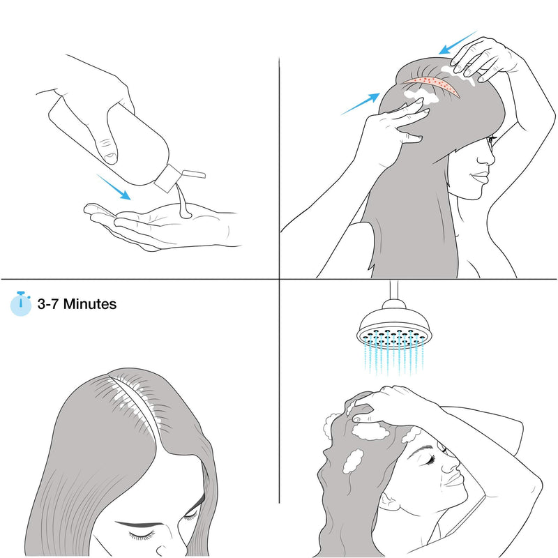 Therapeutic Psoriasis Shampoo (500ml) Salicylic Acid & Dermosoft® 1% - Treatment for Dry, Itchy & Flaky Scalp - Severe Dandruff, Dermatitis - Healpsorin - NewNest Australia