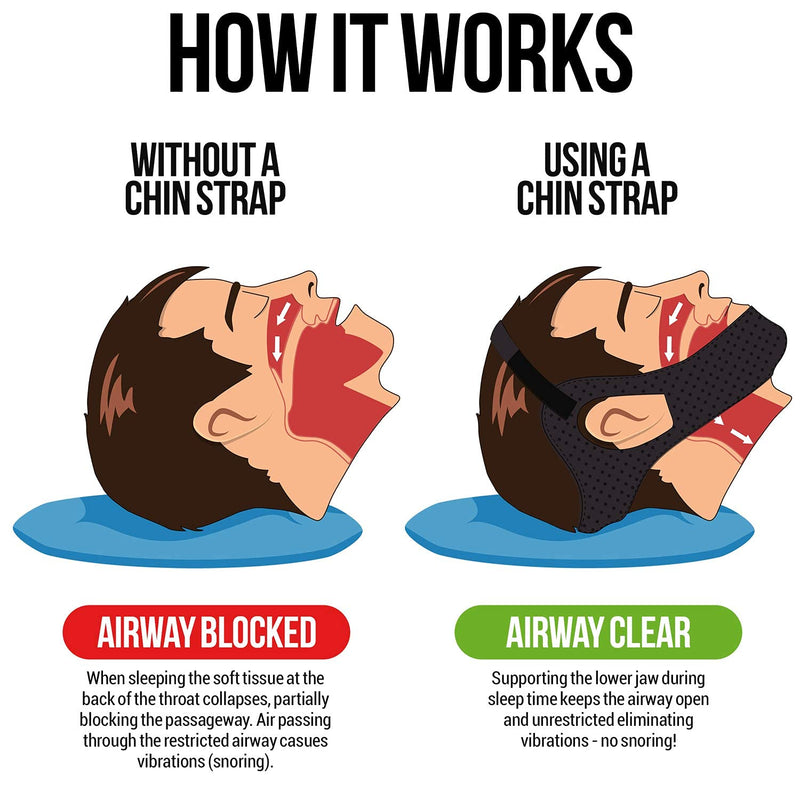 Aveela Premium Anti Snoring Chin Strap for CPAP Users - Most Effective Snoring Solution - High-End Itch-Free Comfortable Breathable Material for Uninterrupted Sleep S - NewNest Australia