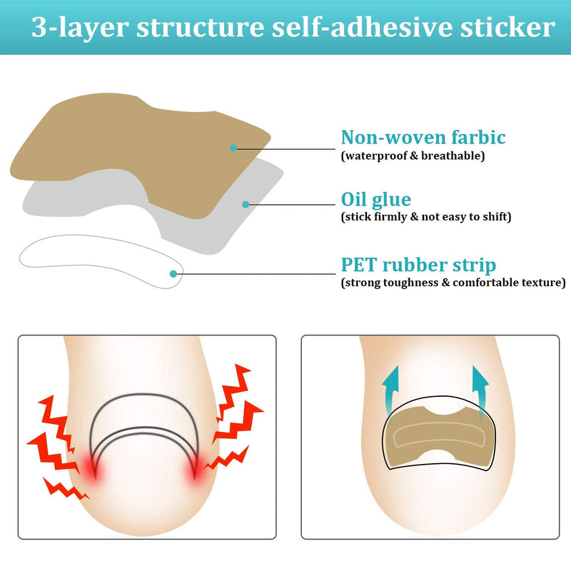 122 Pieces Ingrown Toenail Tool Set, Include Ingrown Toenail File and Lifter, 60 Pieces Elastic Patch Curved Toenails Brace Stickers and 60 Pieces Ingrown Toenail Correction Stickers - NewNest Australia