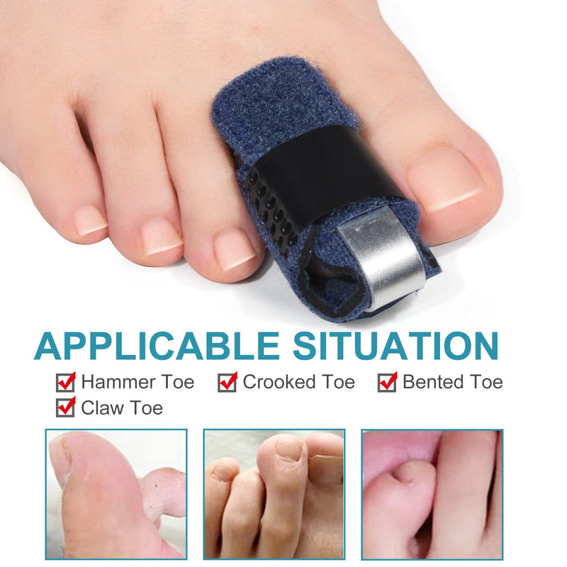 Welnove 1 Pair Toe Splint, Toe Straightener for Hammer Toes, Bent Toes, Claw Toes, Crooked Toes, Toe Wraps for Aligning and Supporting Toes - Blue Blue-Toe - NewNest Australia