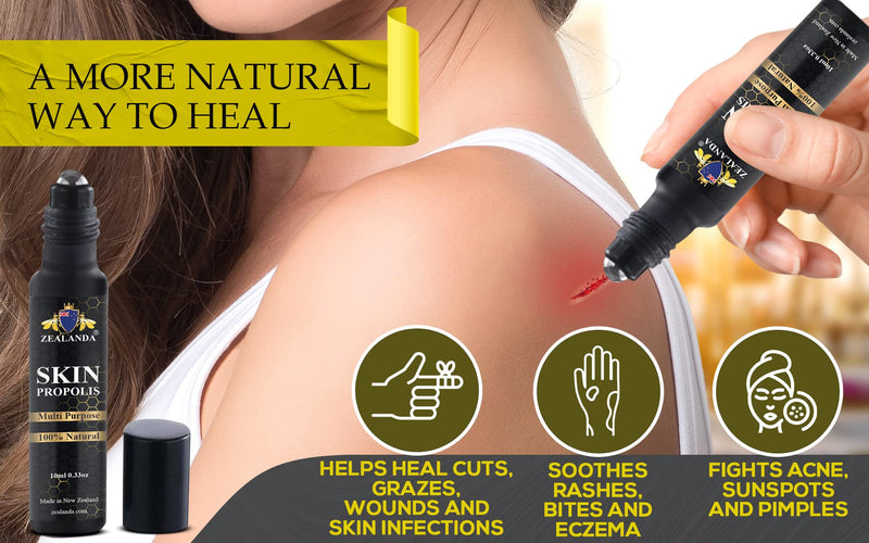 ZEALANDA Skin Propolis, Multi Purpose 100% Natural No Alcohol Treatment for Acne, Pimple, Eczema, Callus, Sunspot,Skin Rash, Insect Bites, Cuts & Wounds. Made & Packed in New Zealand - NewNest Australia