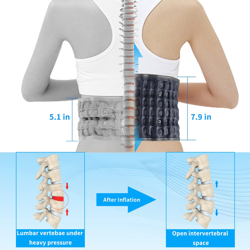 6xigouma Decompression Back Belt - Lumbar Support Belt for Men and Women, Lower Back Pain Relief, Back Traction Device, Fits Waist Size 74-124cm (Blue) Blue - NewNest Australia
