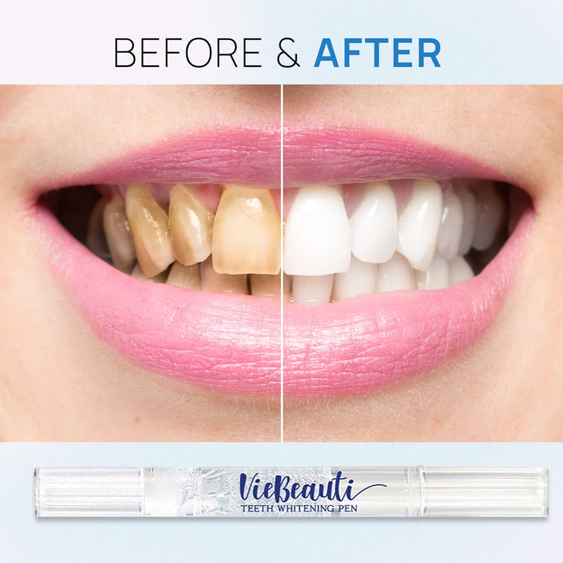 VieBeauti Teeth Whitening Pen(2 Pcs), 20+ Uses, Effective, Painless, No Sensitivity, Travel-Friendly, Easy to Use, Beautiful White Smile, Natural Mint Flavor - NewNest Australia