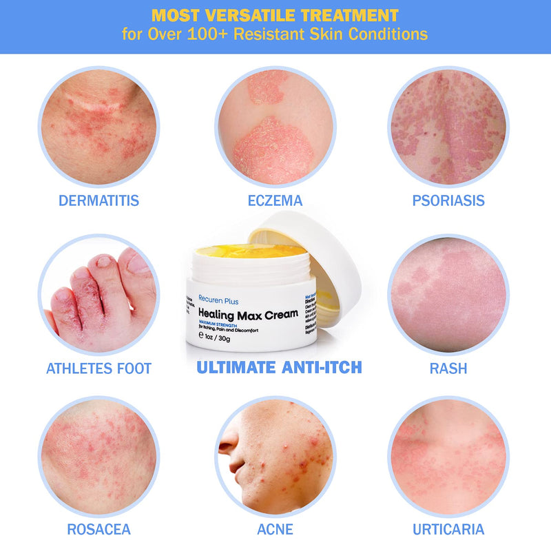 Recuren Plus Healing Max Cream Max Strength for Dermatitis Eczema Psoriasis Athletes Foot Jock Itch Urticaria Rash Rosacea Acne Ultimate Anti-Itch Solution - NewNest Australia