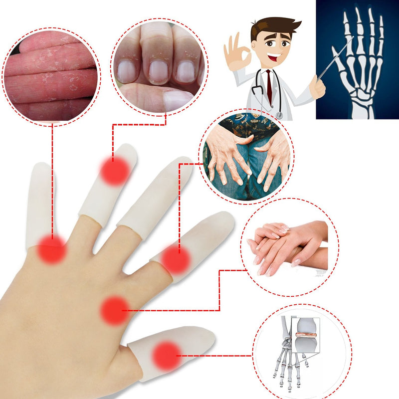 Gel Finger Cots, Finger Protector Support(14 PCS) New Material Finger Sleeves Great for Trigger Finger, Hand Eczema, Finger Cracking, Finger Arthritis and More. (Small Size) (White, Small) - NewNest Australia