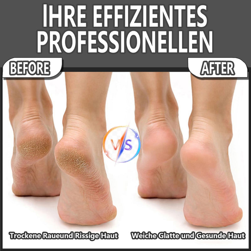 Callus Remover Electric, Rechargeable Callus Removal Foot with Strength Suction and 2 Levels Adjustable, Waterproof Professional Foot Care Pedicure (Black) Acrylonitrile Butadiene Styrene (ABS) - NewNest Australia