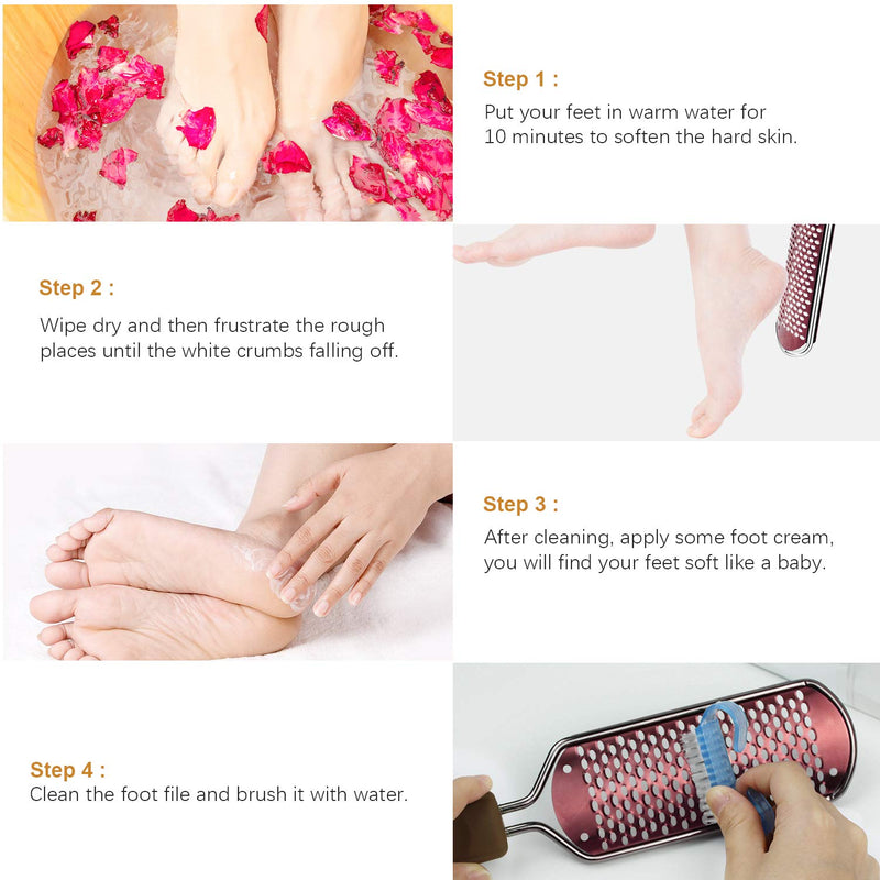 Callus File Callus Remover For Callus Removal Foot, Callus Rasp Foot Callus Remover Professional Stainless Steel Foot File Foot Rasp For Wet And Dry Feet (Rose Gold) - NewNest Australia