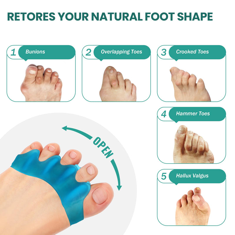Welnove Silicone Toe Separators For Correct Hallux Valgus - 8 Pack Toe Separators For Men'S Feet - Hammer Toe Straightener For Women, Yoga Exercises, Foot Alignment - Blue - NewNest Australia