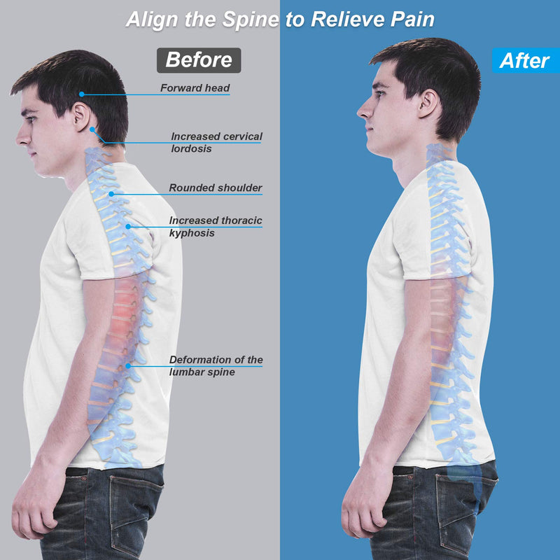 ZINUU Posture Corrector for Men and Women, Back Support Belt with Dual Support Plates Adjustable Back Straightener Brace and Providing Pain Relief from Neck Back & Shoulder Father Gifts-Waist 27"-51" - NewNest Australia