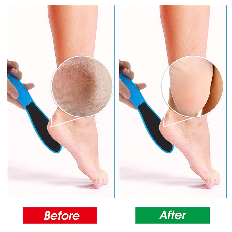 Wllhyf 4 Pieces Double-Sided Pedicure Foot File Foot Scraper Exfoliating Remover Dead Skin Calluses Foot Scrubber Reusable Foot Care Pedicure Tool For Wet, Dry, Cracked Feet - NewNest Australia
