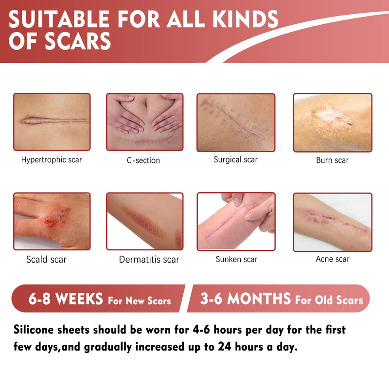 Sugelary Silicone Scar Sheets(1.6”x 120”Roll-3M), Reusable Scar Removal Sheets Easy-Tear Silicone Scar Gel Tape Roll Strips for All Old & New Scars Effective Scar Treatment Sheets Red-120“ - NewNest Australia