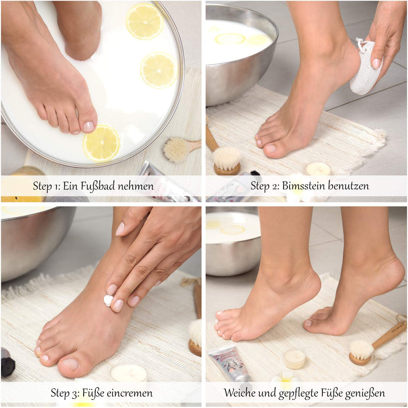 Pumice Stone Foot Care [Set Of 2] Callus Remover Coarse Callus - Hands And Feet - Natural Stone Foot Care Callus Removal Pedicure Foot Scrub Hard Skin Removal (White, Set Of 2) - NewNest Australia