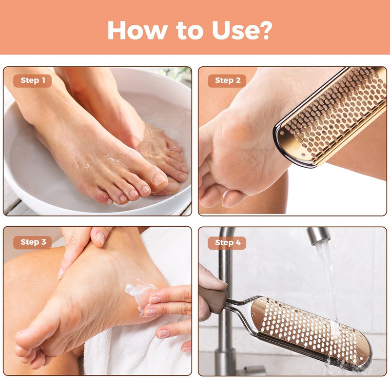 Easkep Foot File Foot Pedicure Tool, Stainless Steel Foot Scrubber Foot File Dead Skin Remover for Hard Skin and Dry Cracked Feet Scraper Classic - NewNest Australia