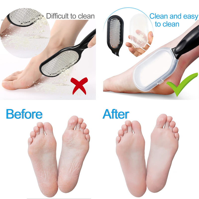 Sularpek Foot File, Foot Scraper, Best Foot Care Pedicure Metal Surface Tool to Remove Hard Skin Can Be Used on Both Wet and Dry Feet, Surgical Grade Stainless Steel File - NewNest Australia
