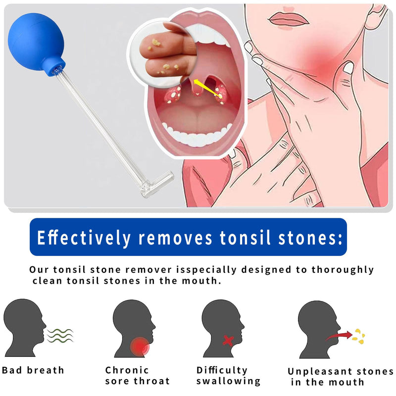 Tonsil stone remover for removing tonsil stones, removing tonsil stones, tonsil stone remover, tonsil stones, tonsil stone cupping glass, cupping glass for tonsil stones made of borosilicate glass - NewNest Australia