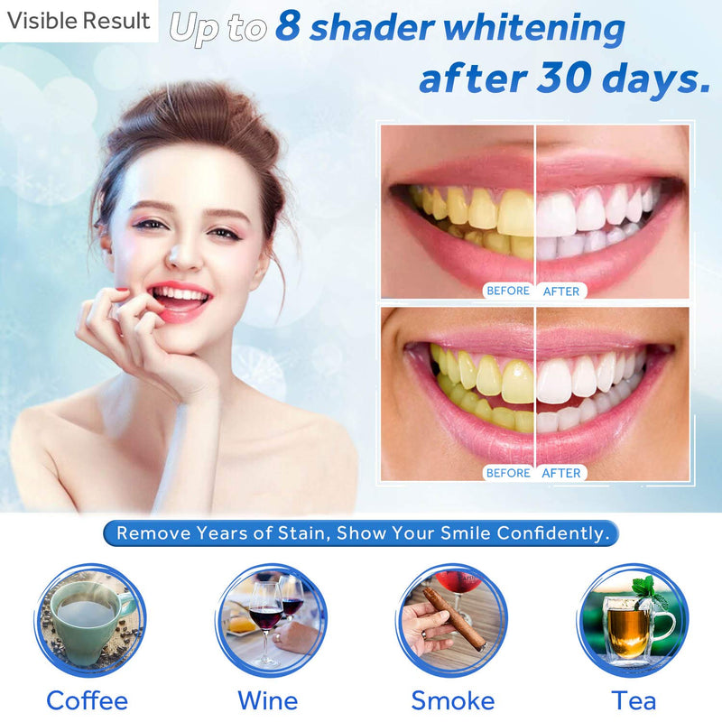 EZGO 10 Pack Teeth Whitening Gel Refills 22% Bleaching Gel, No Sensitive Teeth Whitener, Great for Sensitive Tooth Whitening, Works with Teeth Whitening LED Light and Tray (10X 3ML) 10*3ml-new - NewNest Australia