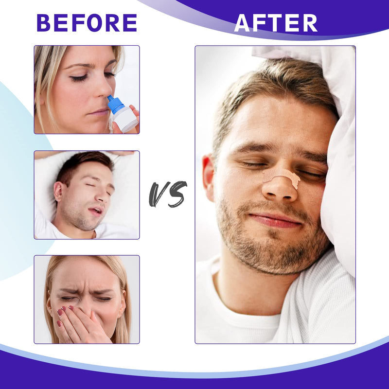 Nasal Strips, 120 Pieces Drug-Free Nose Strips to Stop Snoring and Relieve Nasal Congestion Improves Sleep Nasal Strips Snoring Anti Snore Strips - NewNest Australia