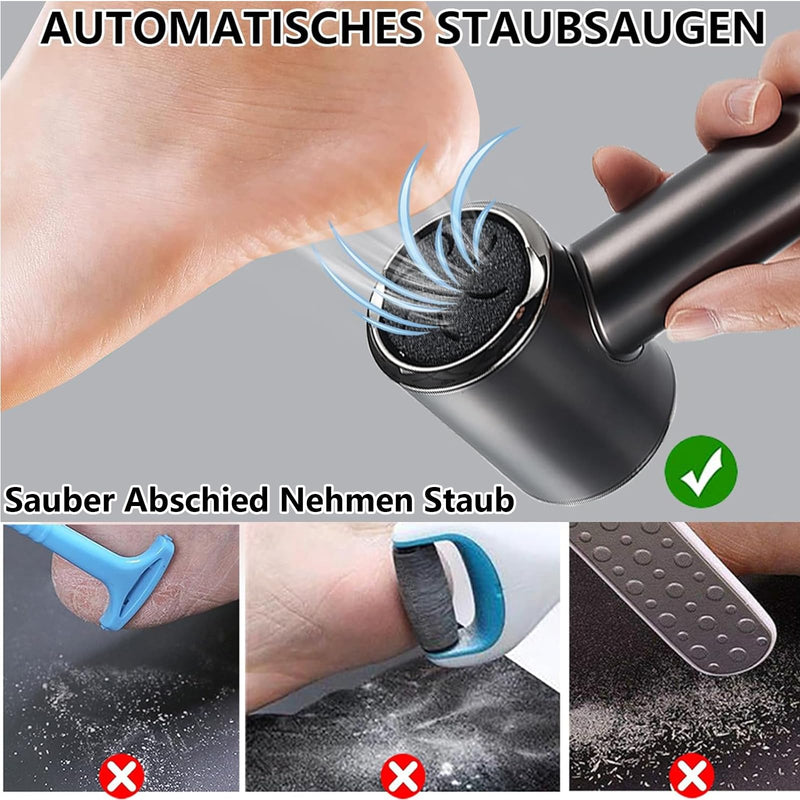 Callus Remover Electric, Rechargeable Callus Removal Foot with Strength Suction and 2 Levels Adjustable, Waterproof Professional Foot Care Pedicure (Black) Acrylonitrile Butadiene Styrene (ABS) - NewNest Australia