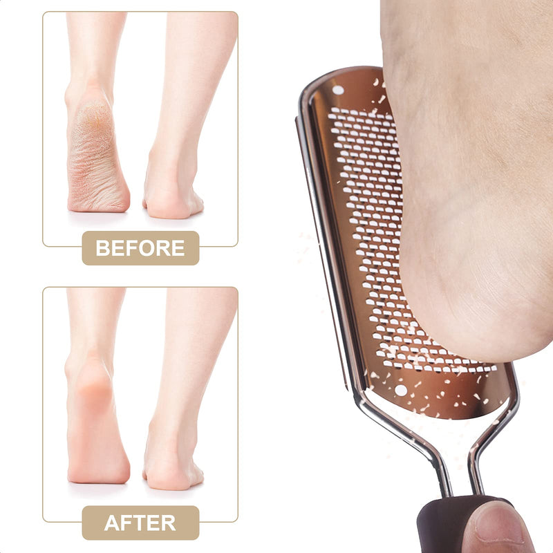 Stainless Steel Foot File, Large Foot Rasp File & 2 Pcs Double-Sided Foot Files, Professional Metal Surface Pedicure File Foot Heel Scraper Dead Skin Callus Remover for Wet and Dry Cracked Feet-Brown Champagne - NewNest Australia