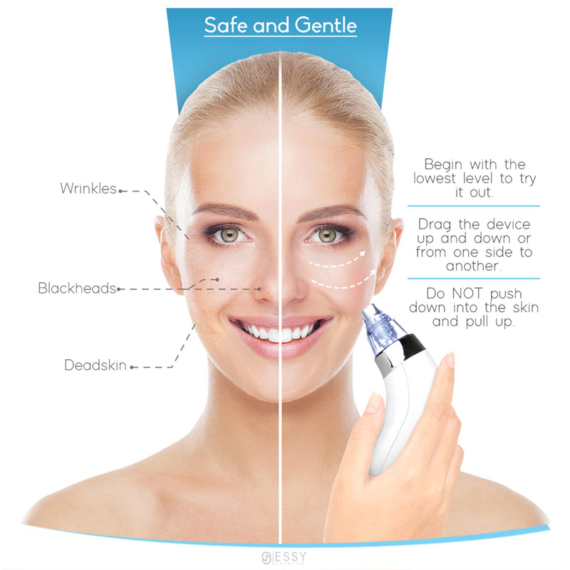 Blackhead Remover Vacuum Pore Cleaner Acne Comedone Extractor Face Pore Vacuum Blackhead Remover Tool Facial Pore Cleanser Sucker Spot Pimple Whitehead Black Head Deep Suction - NewNest Australia