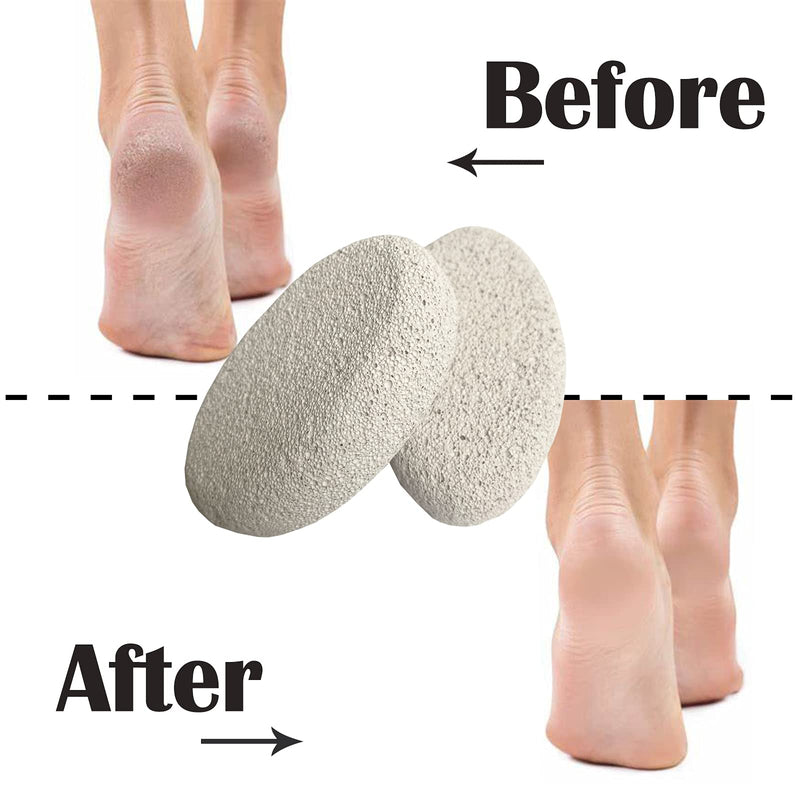 2 Pcs Natural Pumice Stone for Feet, Foot Scrubber Stone, Foot Care, Hands, Body, Pedicure Exfoliator Tools for Dead/Hard Skin - NewNest Australia