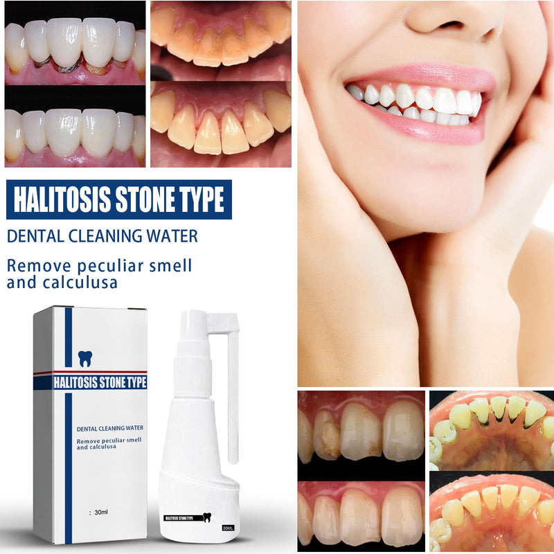 Teeth whitening mouth spray, tooth cleaning spray, tartar spray, tartar-free dissolving tooth spray, tartar remover, removes yellow tooth stains, protects oral hygiene and oral care 30ml - NewNest Australia