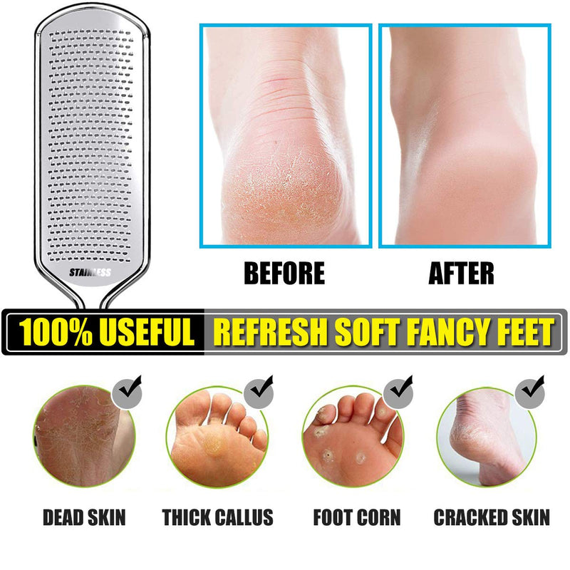 Colossal Foot File, Foot Scrubber with Precision Pedicure Rasp Callus Remover Foot Files for Easy Trimming Dead Skin, Callus, Foot Corn, Cracked Heels - NewNest Australia