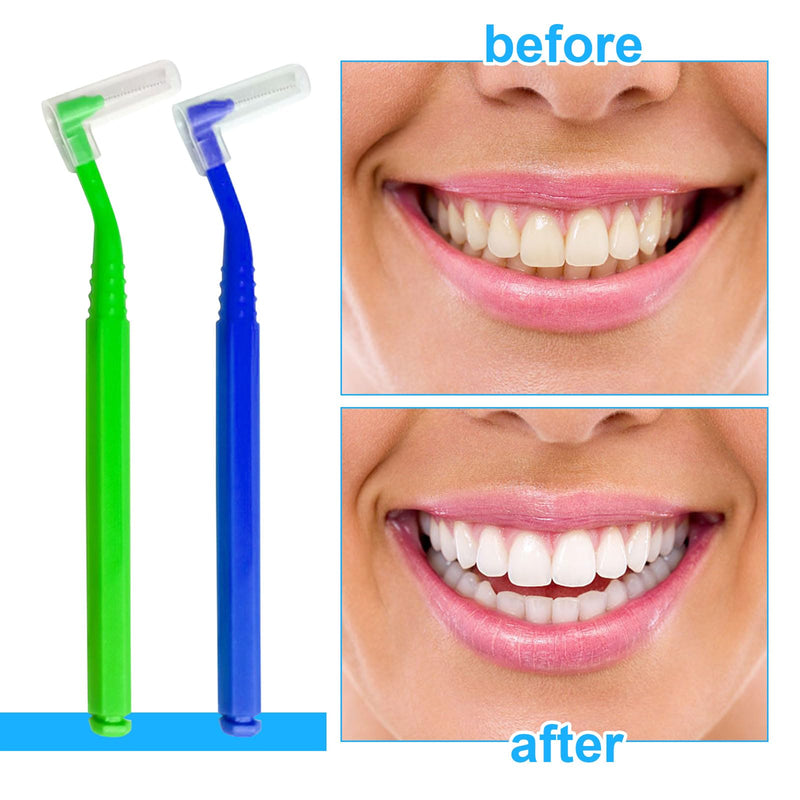 SKHAOVS Pack of 50 interdental brushes, toothbrushes for between teeth and gums, gap brush with non-slip handle, orthodontic universal care, braces cleaning, 5 colors - NewNest Australia