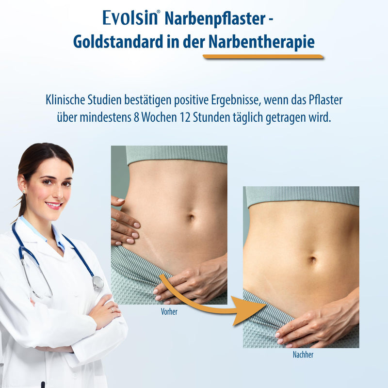Evolsin® Transparent scar plaster - for all types of scars - silicone scar plaster visibly reduces scars - for easy treatment (200 cm) - NewNest Australia