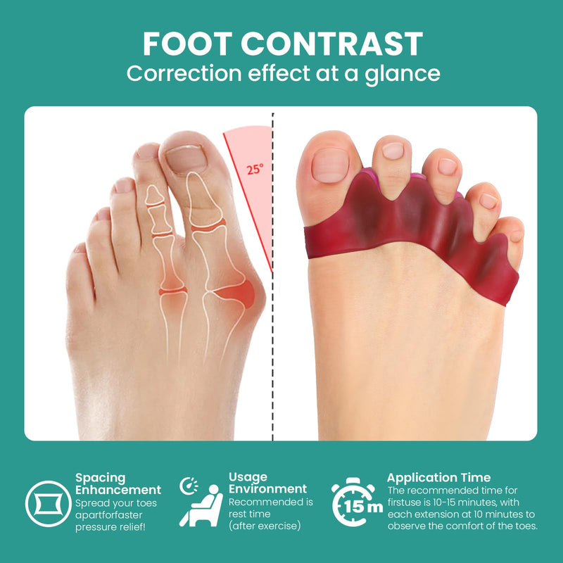 Welnove Toe Separators, Bunion Corrector - 8 Pieces Gel Toe Straighteners To Restore Original Shape Of Hammer Toe For Women And Men, Toe Spacers For Gifts (Deep Red) - NewNest Australia