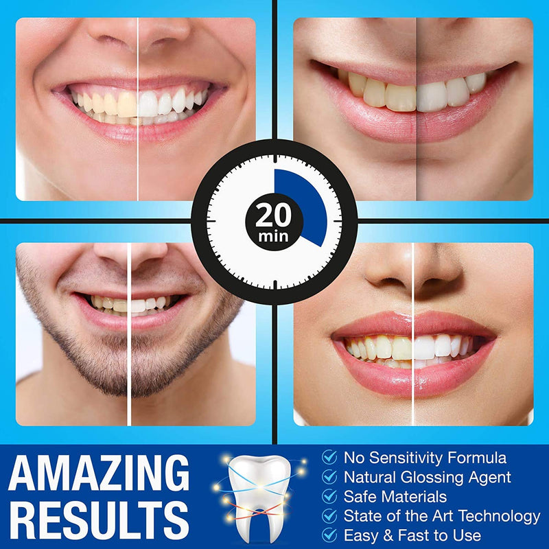 Teeth Whitening Kit Refills | Pro Intellident Advanced Gel & Stain Remover | Longer Lasting Results Than Whitening Strips or Activated Charcoal | Ideal Tooth Whitener for Sensitive Teeth - NewNest Australia