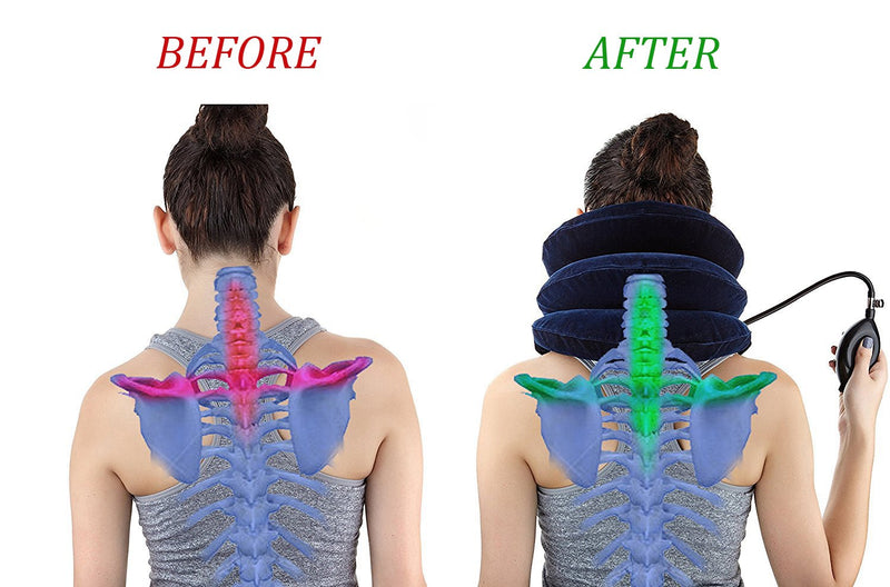 Cervical Neck Traction Device Inflatable Neck Stretcher, Easy to Use for Chronic Neck and Shoulder Pain Relief, Neck Cervical Brace Collar Pillow for HOM Blue - NewNest Australia