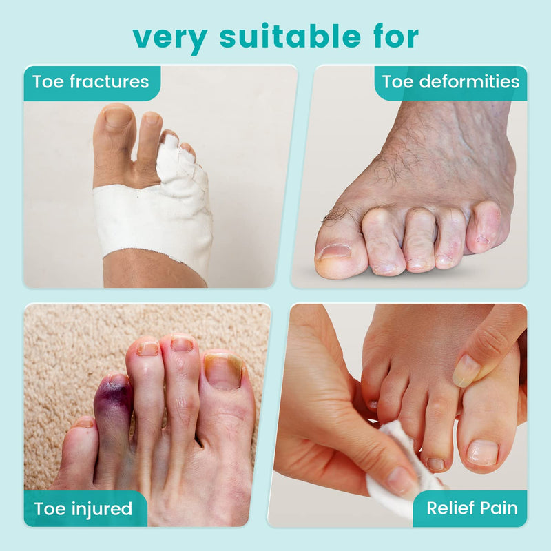 Toe Splint,U-Shaped Toe Corrector Brace, Toe Straightener of Adjustable Fixed Support,For Toe Injuries,Fractures,Sprains,Overlapping Toe,Hammer Toe,Claw Toe,Crooked Toe,Fits Men And Women - Blue - NewNest Australia
