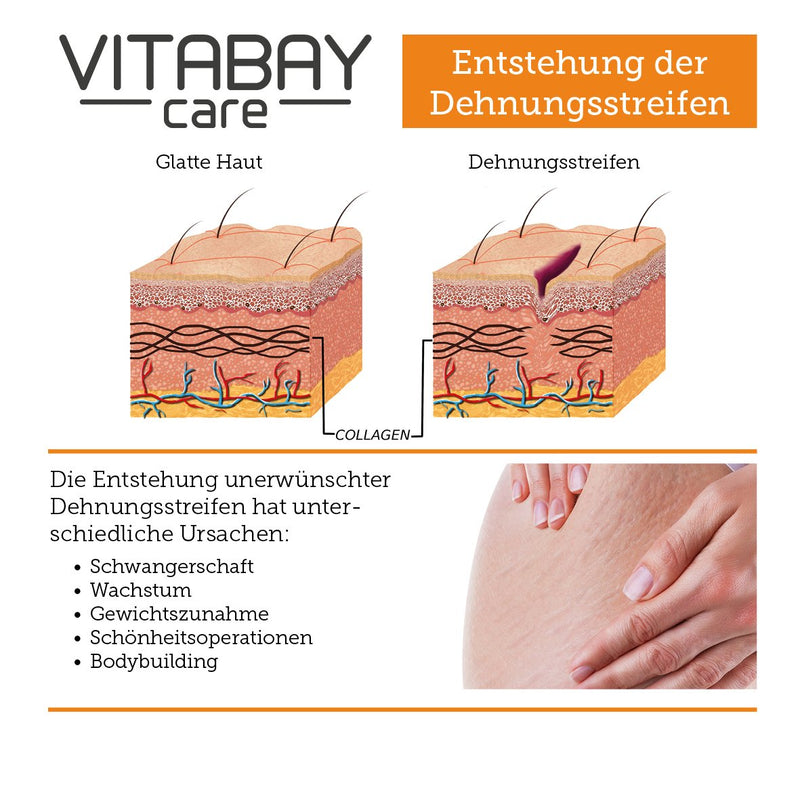 Vitabay Stretch Mark Cream 100 ml • Special care to prevent and reduce stretch marks - NewNest Australia