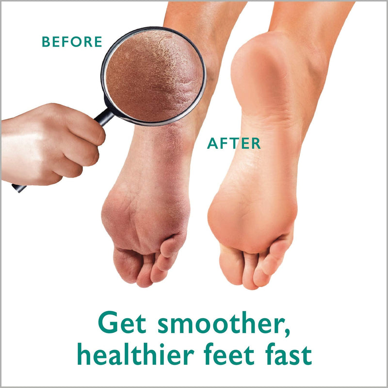 Callus Remover Gel + Foot Scrubber Kit - Pedicure Tools for Dry Cracked Heels - NewNest Australia