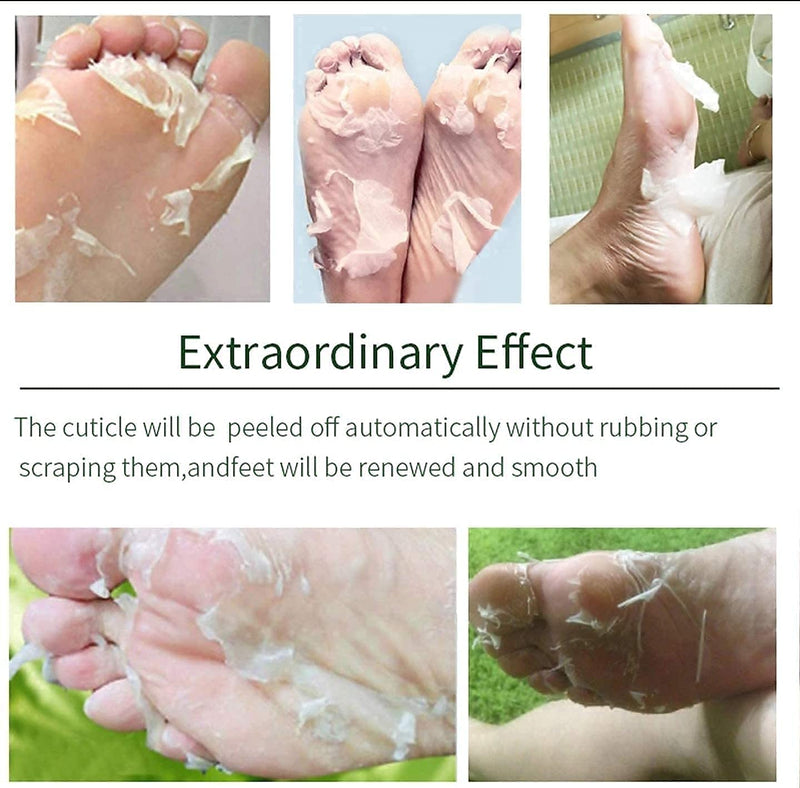 Aloe Vera Exfoliating Foot Peeling Mask Sock - Moisturising Peel Masks - remove Hard Skin Callus Remover Pedicure Baby Feet Care Kit for Cracked Feet - NewNest Australia