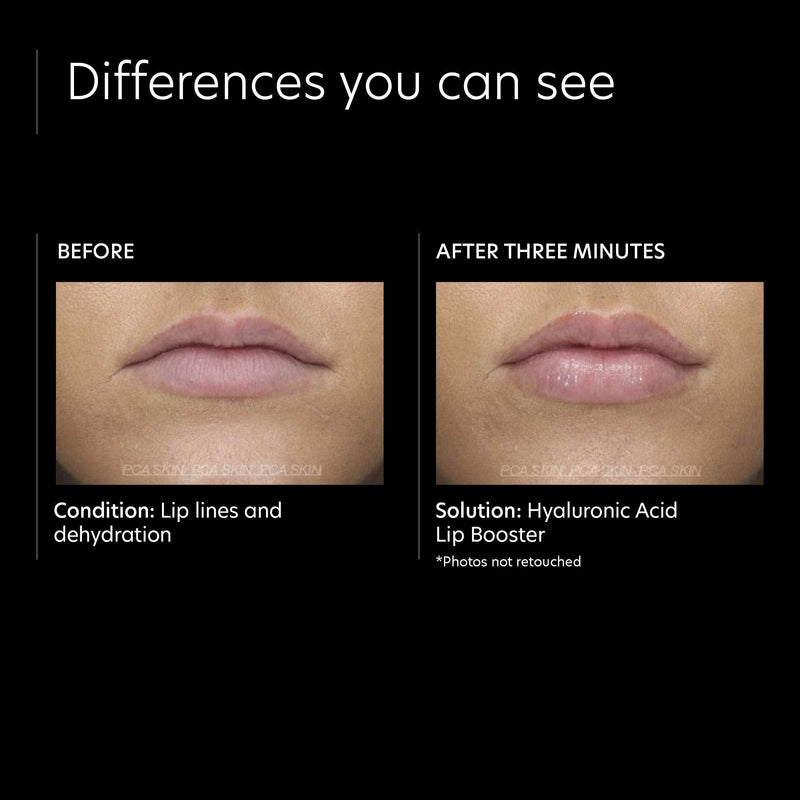 PCA SKIN Hyaluronic Acid Lip Plumper - Natural Hydrating Lip Enhancer to Moisturize Dry Lips & Reduce Fine Lip Lines (0.24 oz) - NewNest Australia