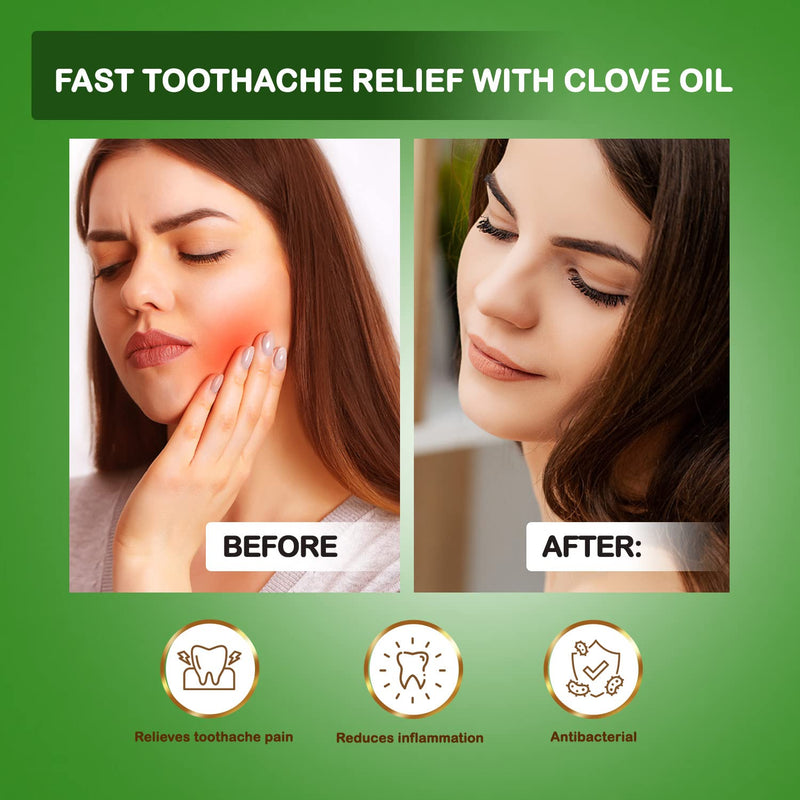 NPOW Clove Oil, Clove Essential Oil, Clove Oil for Toothache Pain Relief, Clove Oil for Hair Growth, Oil of Cloves for Toothache, Essential Oil for Oral Discomfort - 10ml 10 ml (Pack of 1) - NewNest Australia