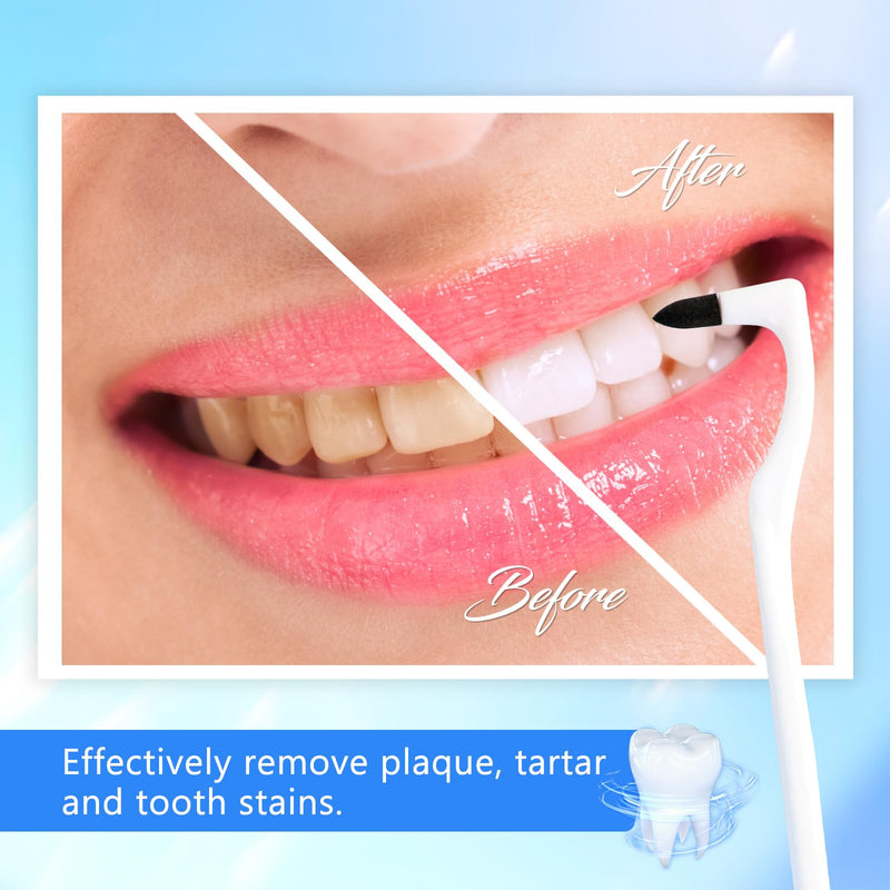Sularpek Pack of 3 Tartar Remover, Toothbrush Stain Remover, Tooth Polisher, Professional Teeth Cleaning, for Removes Discoloration, Plaque & Tartar (Mixed Colors) - NewNest Australia