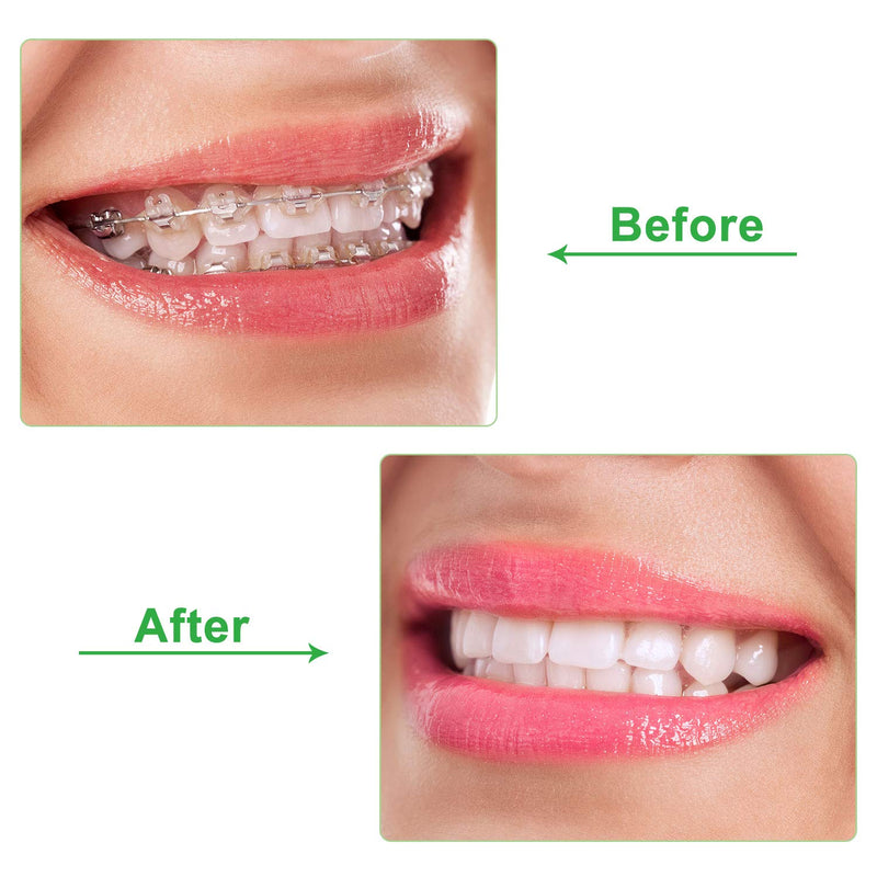 10 Pieces Aligner Chewies for Aligner Chompers Aligner Trays Seater Orthodontic Dental Chewies Green - NewNest Australia