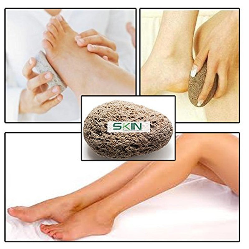 Skinapeel Large Pumice Stone - Natural Foot Care Scruber - Dead Hard Skin Callus Remover - Pedicure Tool - Skinapeel UK Skincare Specialists - NewNest Australia