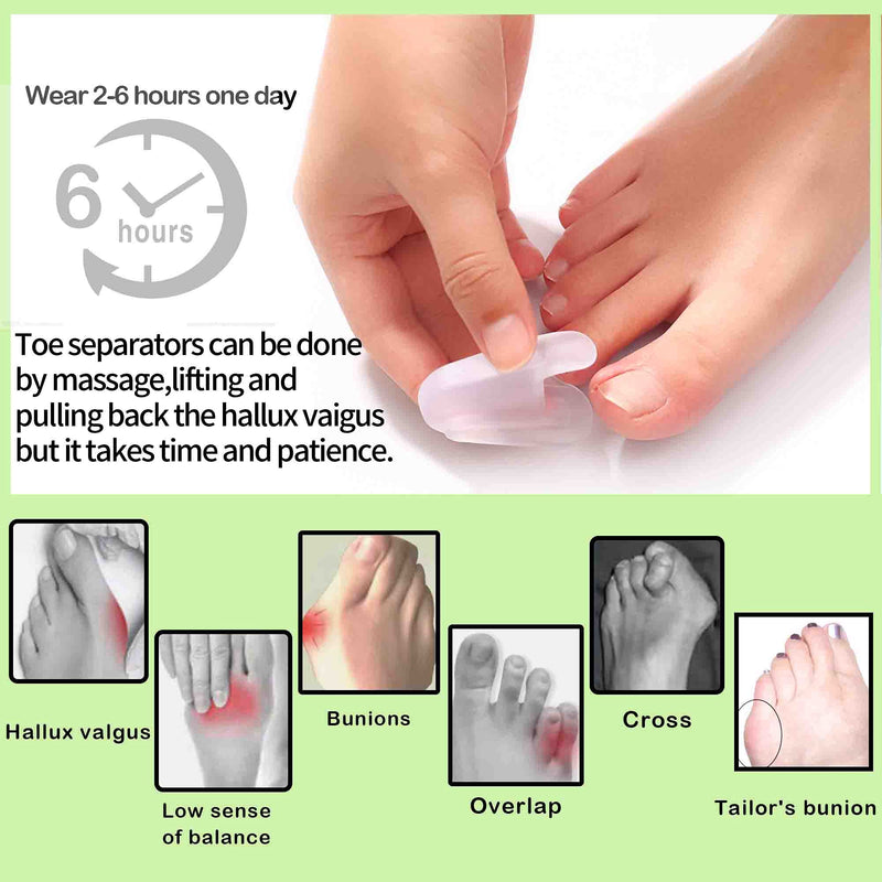 DYKOOK Flared Gel Toe Separators 8 Pieces Big Small Toe Spacers Toe Straighteners for Overlapping Toes and Temporary Bunion Corrector Gel (4 pcs Large + 4 pcs Small) - NewNest Australia
