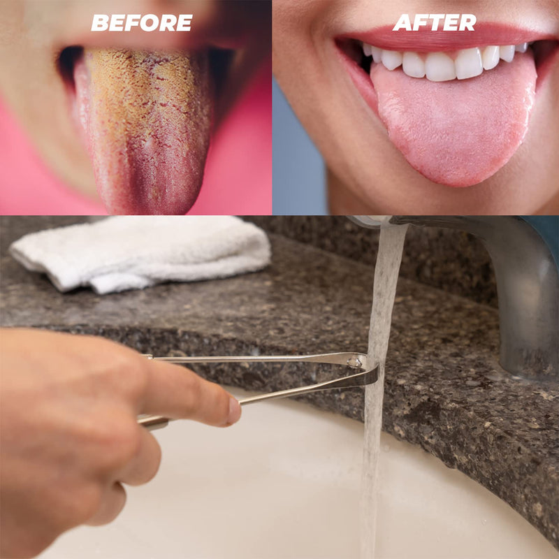 ZEEX Tongue Scraper – 2-Pack Metal Tongue Scraper for Daily Cleaning – Stainless Steel Tongue Scrapers for Adults – Tongue Cleaner for Fresh Breath and Plaque Removal - NewNest Australia