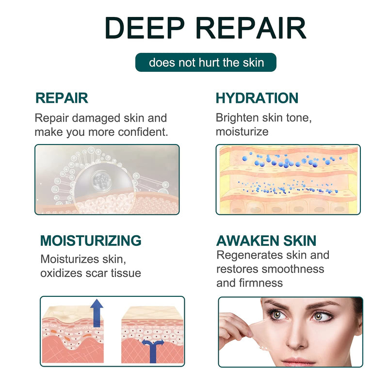 Silicone Scar Removal Roll (3M-1.6” x 120”), Scar Removal Strips Medical Grade, Scar Sheets Reusable, Scar Tape Professional for C-Section, Surgery, Burn, Keloid, Acne 1.5m-1.6” X 120”roll - NewNest Australia